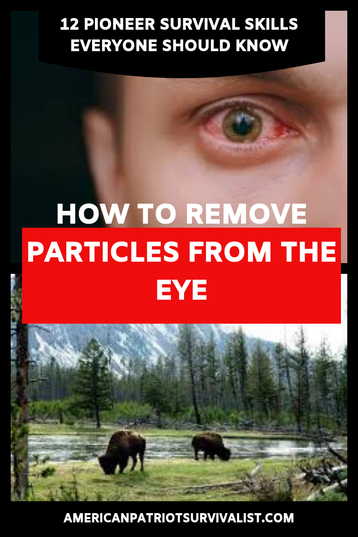 How to Remove Particles from the Eye